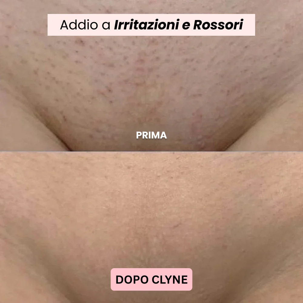 Rasoio CLYNE- Vellora