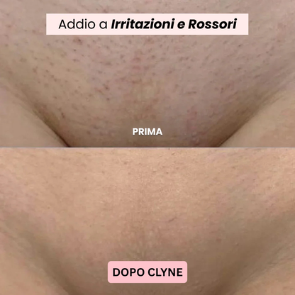 Rasoio CLYNE- Vellora