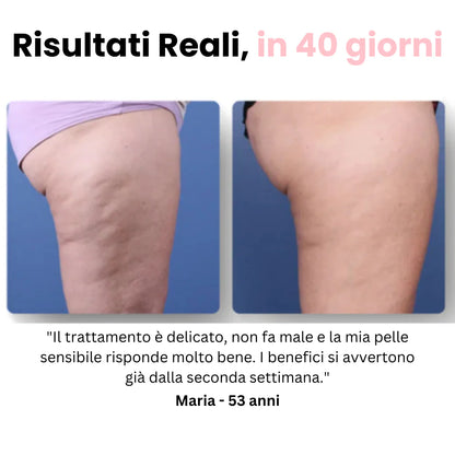 Vellora™ - Massaggiatore